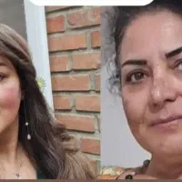 لیزرموزائدتیتانیوم آلما اصلی