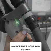 لیزر کندلا اصلی برای موهای زائد در مطب روشا