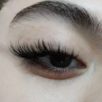 کاشت مژه