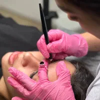 میکروبلاگینگ و فیبروز ابرو