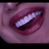 زیر قیمت بیمه، ۵۰درصد تخفیف واقعی خدمات دندانپزشکی
