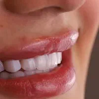 خدمات دندانپزشکی لمینت دندان کامپوزیت ودرمانی|خدمات آرایشگری و زیبایی|تهران, فلسطین (میدان انقلاب)|دیوار