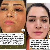 عرضه کننده محصولات  اصلی و تضمینی