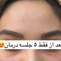 فیشیال وپاکسازی پوست ویژه بانوان|خدمات آرایشگری و زیبایی|سقز, |دیوار