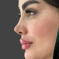 تخفیف عمل بینی لیپو ابدو لیفت ابرو وکاشت ابرو و مو