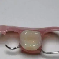 دندان مصنوعی طرح لبخند کامپوزیتی|آرایشی، بهداشتی، درمانی|ارومیه, |دیوار