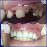 دندانپزشکی،ایمپلنت،ارتودنسی لمینت وکامپوزیت اقساطی|خدمات آرایشگری و زیبایی|نجف‌آباد, شریعتی غربی|دیوار