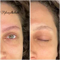 پذیرش محدود مدل میکروبلیدینگ ابرو رشت