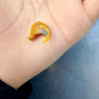 ناخون پلنگ