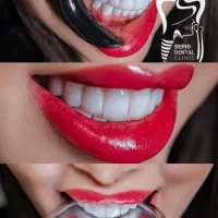 جشنواره یلدایی دندانپزشکی