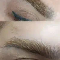 ریموو تک جلسه ای(پاک کردن)ابرو خط چشم خطلب و بدن