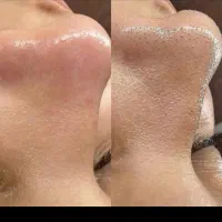 اف تمامی خدمات سالن زیبایی باپرسنل حرفه ای|آرایشگاه و سالن‌های زیبایی|دورود, |دیوار