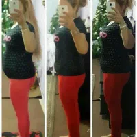 درمان چاقی و لاغری و ماساژ|آرایشی، بهداشتی، درمانی|تبریز, |دیوار