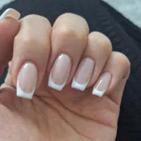 کاشت و ترمیم با بهترین قیمت و کیفیت گلشهر