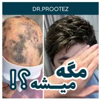 پروتزمو (دکترپروتز)|خدمات آرایشگری و زیبایی|اصفهان, هزارجریب|دیوار