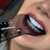 دندانپزشکی نیاز به بیماریاب