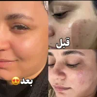 کرم لک|آرایشی، بهداشتی، درمانی|اهواز, دغاغله|دیوار