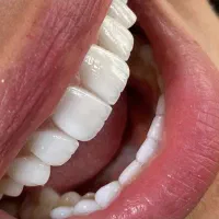 کامپوزیت|پزشکی|خرم‌آباد, |دیوار