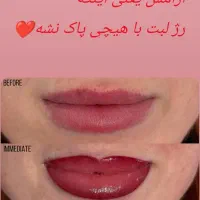مرکزفیبروز وشیدینگ با موادبدون سرب وگیاهی آمریکایی|خدمات آرایشگری و زیبایی|کرمانشاه, |دیوار