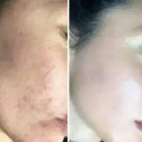 کرم معجزه شب اصل|آرایشی، بهداشتی، درمانی|دورود, |دیوار