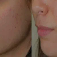 فشیال،موخوره گیری،پدیکور،لیفت ابرو