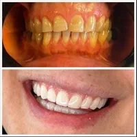 کامپوزیت و خدمات دندانپزشکی دولت اباد