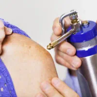 کرایو تراپی خانگی انواع ضایعات پوستی