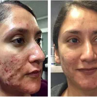 فیشال(پاکسازی) اقتصادی صورت vip