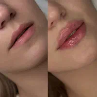 پوست مو زیبایی و لیزر موهای زائد