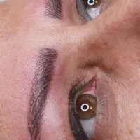 مدل برای فیبروز ابرو