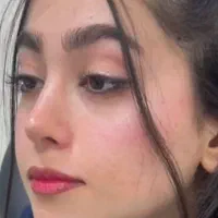 عمل بینی ، بلفارو ، غبغب ، کاشت ابرو