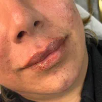 مدل ژل و بوتاکس|خدمات آرایشگری و زیبایی|اصفهان, شهرک کاوه|دیوار