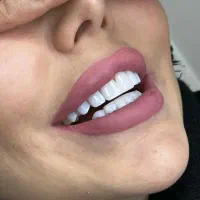 .عصب کشی 2500 . روکش 3 تومن . کاشت 10|خدمات زیبایی و سلامت|کرمانشاه, |دیوار