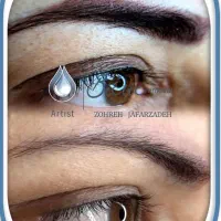 پاک کردن تتوهای قدیمی در کمترین جلسات