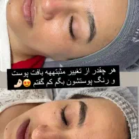 پاکسازی پوست فیشال پوست فیشیال پوست|خدمات آرایشگری و زیبایی|تهران, مجیدیه|دیوار