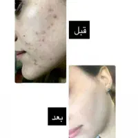 روشن کننده ۳۹۹|آرایشی، بهداشتی، درمانی|جیرفت, |دیوار