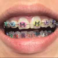 ارتودنسی تخصصی برای همه. اقساطی.بزرگسالان وکودکان