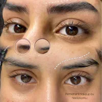 مدل میکروبلیدینگ میناب