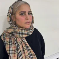 تزریق چربی صورت\فیلرلب/فیلربادی/بوکالفت/غبغب