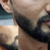 مرد بدون ریش و مو کنسله..