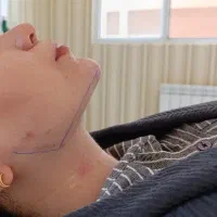 کیلینک زیبایی پاستور تخصصی ترین کیلینک زنجان|خدمات آرایشگری و زیبایی|زنجان, |دیوار