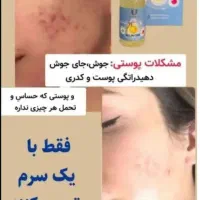 نمایندگی رسمی سرم مغذی لاکچری کوین (۱۲ کاره) اصل|آرایشی، بهداشتی، درمانی|تهران, سعادت‌آباد|دیوار