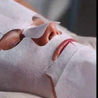 مدل کربوکسی تراپی