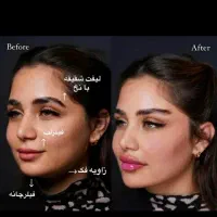 مطب زیبایی تپش .جشنواره تخفیف/لیزر/ژل بوتاکس|خدمات آرایشگری و زیبایی|گلبهار, شهر جدید گلبهار|دیوار