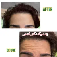 انجام کلیه خدمات زیبایی توسط پزشک در کلینیک در فسا|خدمات آرایشگری و زیبایی|فسا, |دیوار