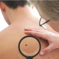 جراحی های ختنه ناخن لیپوم خال میخچه بخیه نوار قلب|خدمات آرایشگری و زیبایی|مشهد, الهیه|دیوار