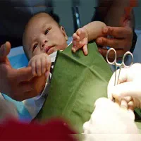 انجام ختنه با روش جراحی نوین