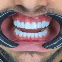 دندانپزشکی و ایمپلنت و کامپوزیت و ارتودنسی|خدمات آرایشگری و زیبایی|سرپل ذهاب, |دیوار