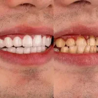 مژده به اهالی محترم گلباف در مورد دندانپزشکی|خدمات آرایشگری و زیبایی|گلباف, |دیوار