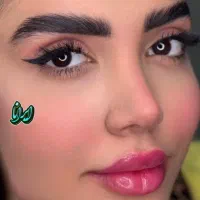 تزریق فیلر،ژل با متد جدید (کلینیک ایرانا)